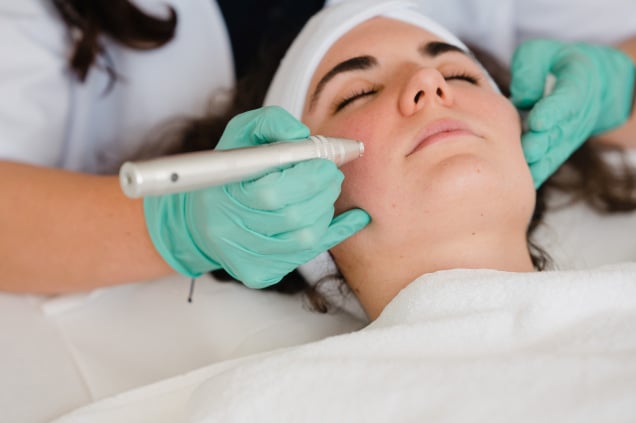 Mikro-Needling